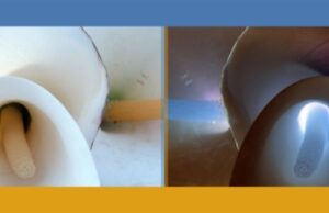 Javier Abella, desde el positivo y el negativo